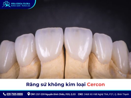 Răng sứ không kim loại - ảnh 5 Răng sứ không kim loại - ảnh 5