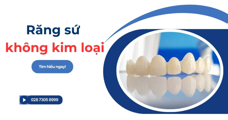 Răng sứ không kim loại