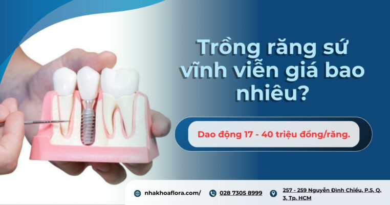 Trồng răng sứ vĩnh viễn giá bao nhiêu