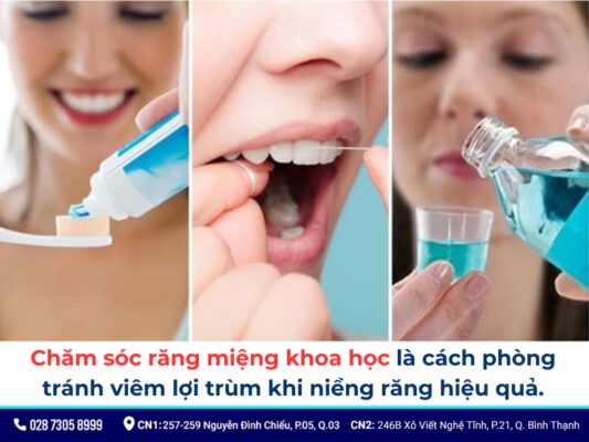 lợi trùm khi niềng răng - ảnh 5