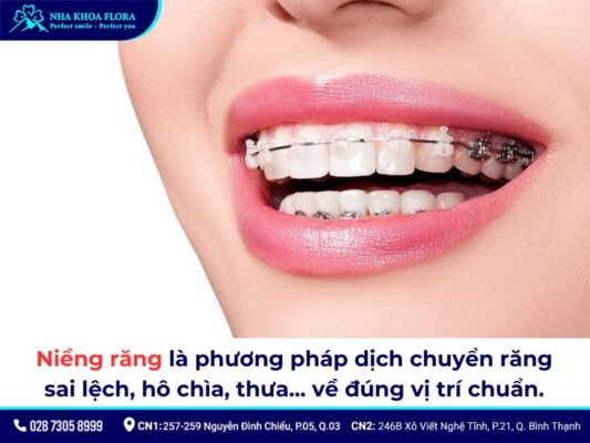 niềng răng - ảnh 1