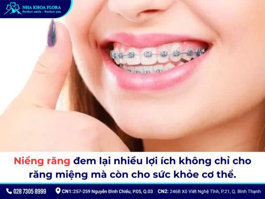 niềng răng - ảnh 3