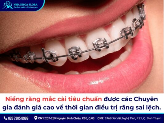 niềng răng 4 năm - ảnh 3