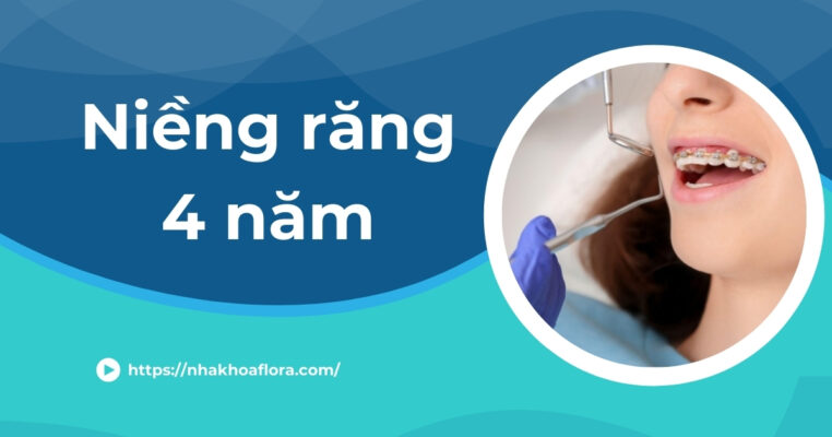 niềng răng 4 năm