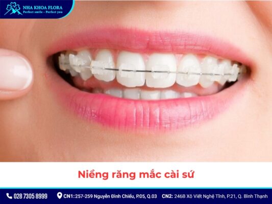 niềng răng - ảnh 5