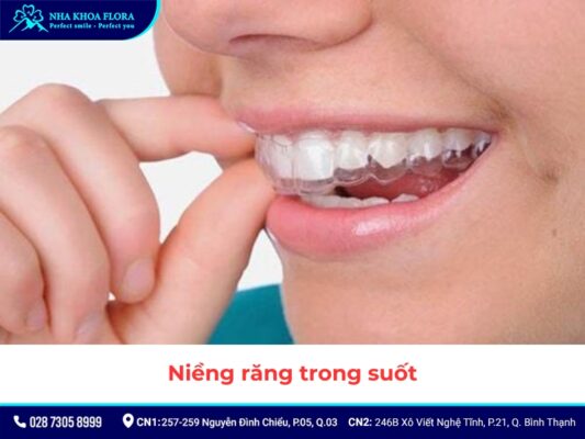 niềng răng - ảnh 7