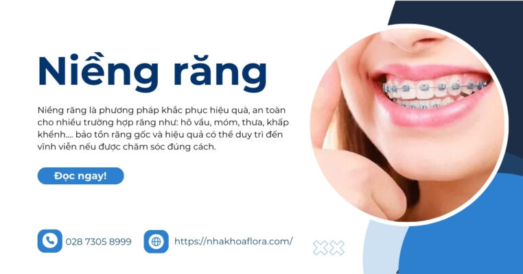 niềng răng