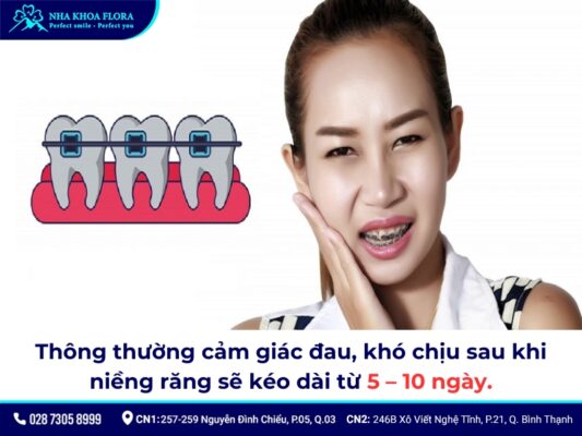 niềng răng bao lâu thì hết đau - ảnh 1