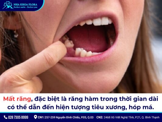 niềng răng bị hóp má - ảnh 1 niềng răng bị hóp má - ảnh 1