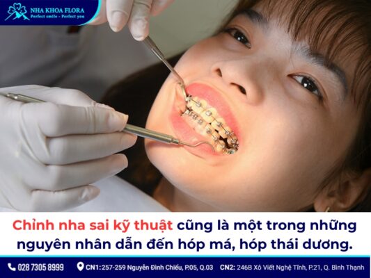 niềng răng bị hóp má - ảnh 3 niềng răng bị hóp má - ảnh 3