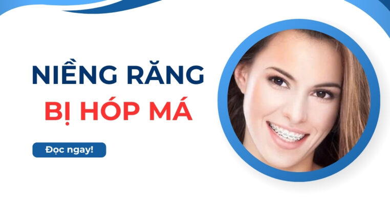niềng răng bị hóp má