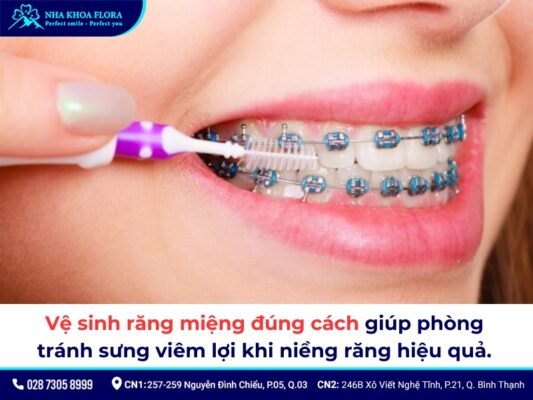 Niềng răng bị sưng lợi: Nguyên nhân và biện pháp khắc phục 1