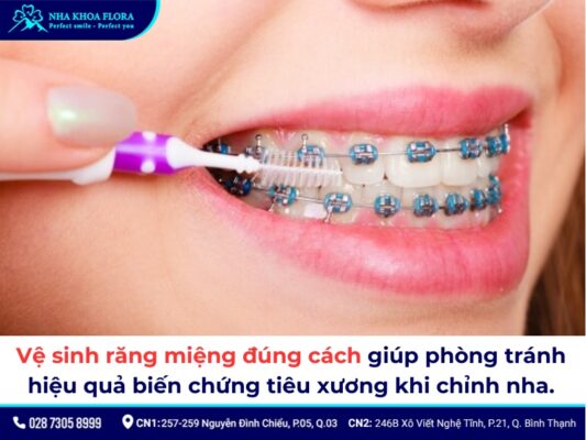 niềng răng bị tiêu xương - ảnh 6