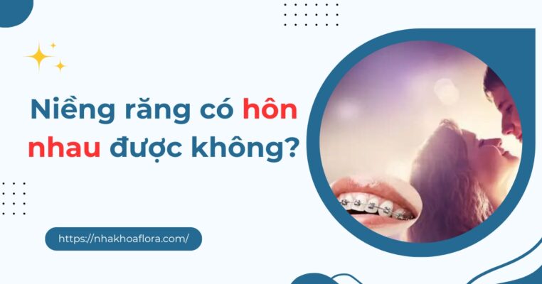 niềng răng có hôn nhau được không
