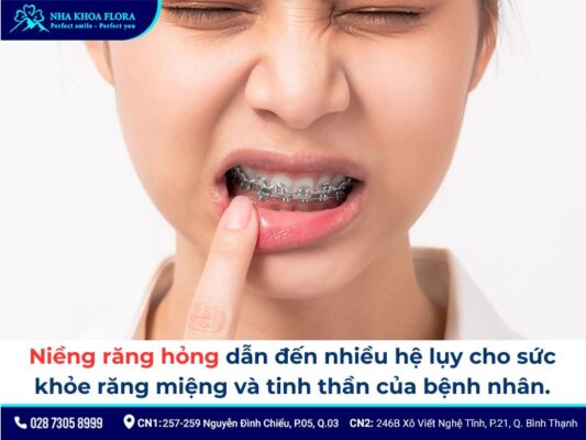 niềng răng hỏng - ảnh 7 niềng răng hỏng - ảnh 7