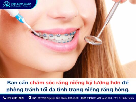 niềng răng hỏng - ảnh 9 niềng răng hỏng - ảnh 9