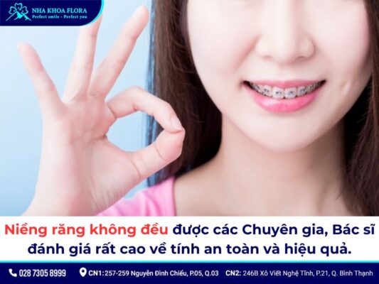 niềng răng không đều - ảnh 4 niềng răng không đều - ảnh 4