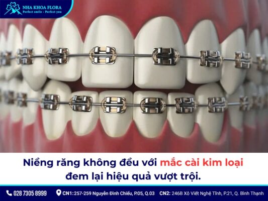 niềng răng không đều - ảnh 5 niềng răng không đều - ảnh 5