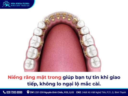 niềng răng không đều - ảnh 7 niềng răng không đều - ảnh 7