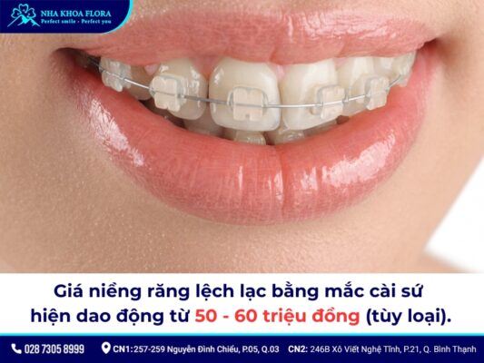 niềng răng lệch lạc giá bao nhiêu - ảnh 2