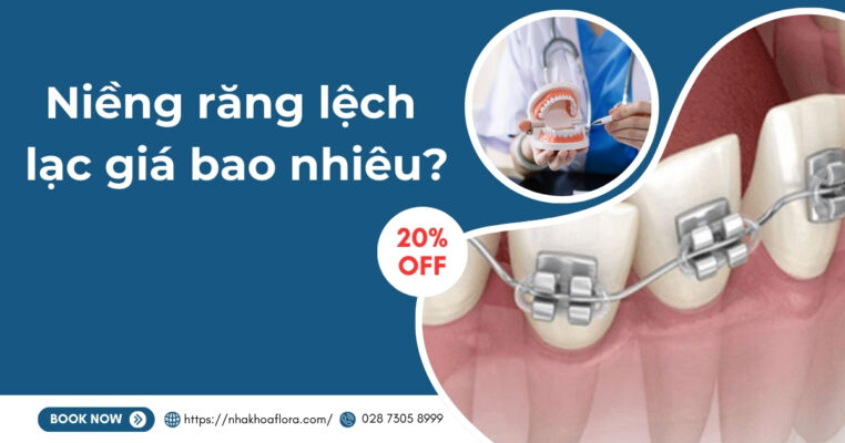 niềng răng lệch lạc giá bao nhiêu