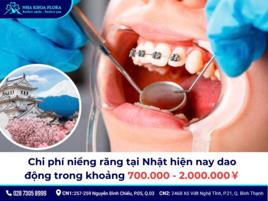 niềng răng ở Nhật giá bao nhiêu - ảnh 1 niềng răng ở Nhật giá bao nhiêu - ảnh 1