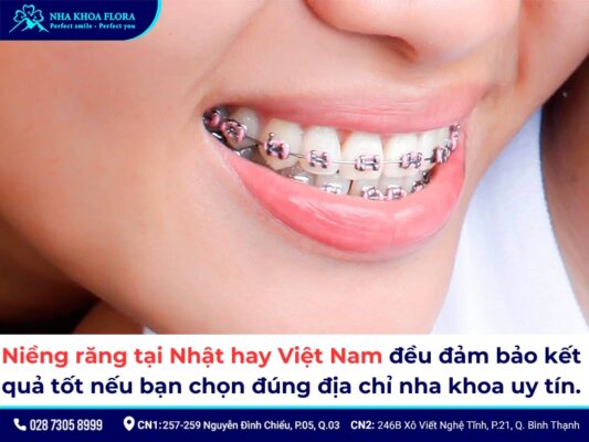 niềng răng ở Nhật giá bao nhiêu - ảnh 3 niềng răng ở Nhật giá bao nhiêu - ảnh 3