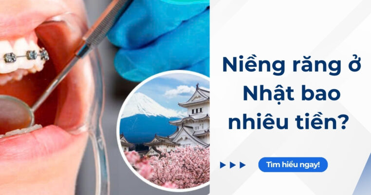 niềng răng ở Nhật giá bao nhiêu