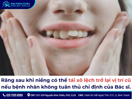 niềng răng xong bị chạy răng - ảnh 1 niềng răng xong bị chạy răng - ảnh 1