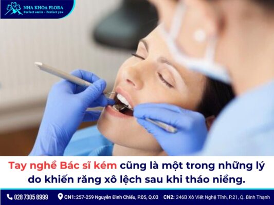 niềng răng xong bị chạy răng - ảnh 3 niềng răng xong bị chạy răng - ảnh 3