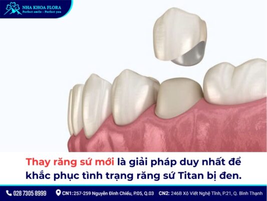 răng sứ Titan có bị đen không - ảnh 4
