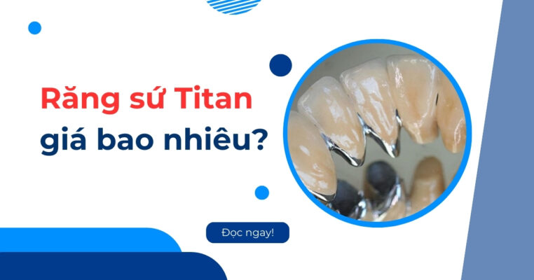 răng sứ Titan giá bao nhiêu
