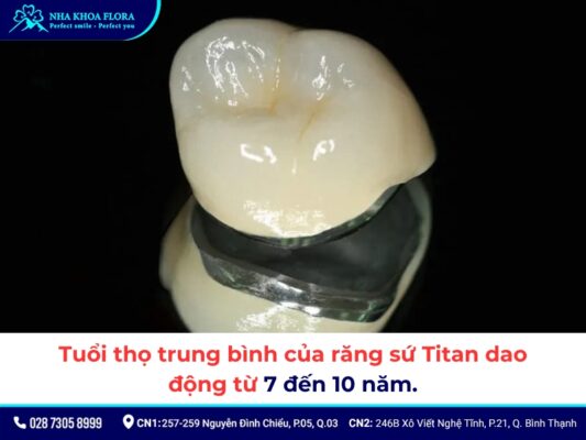 răng sứ Titan sử dụng được bao lâu - ảnh 1