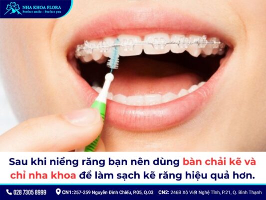 sau khi niềng răng - ảnh 3 sau khi niềng răng - ảnh 3