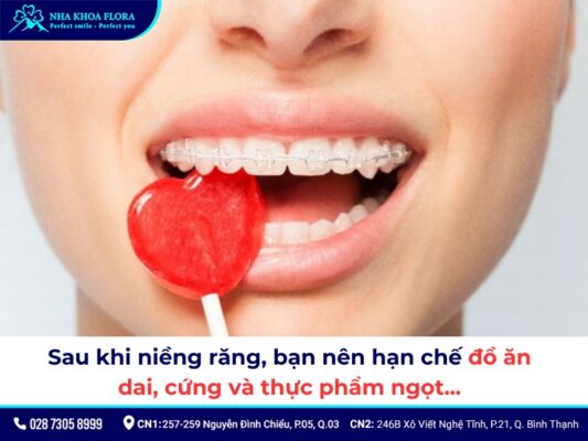 sau khi niềng răng - ảnh 5 sau khi niềng răng - ảnh 5