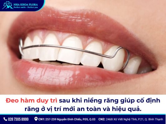 sau khi niềng răng - ảnh 7 sau khi niềng răng - ảnh 7