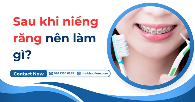 sau khi niềng răng