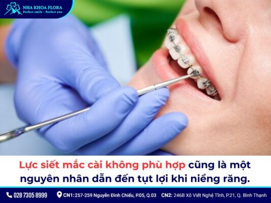 tụt lợi khi niềng răng - ảnh 5