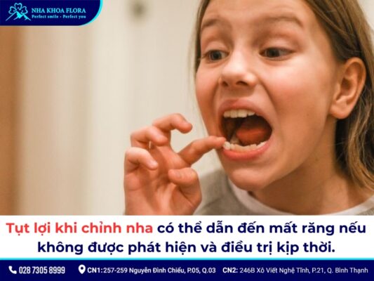 tụt lợi khi niềng răng - ảnh 6