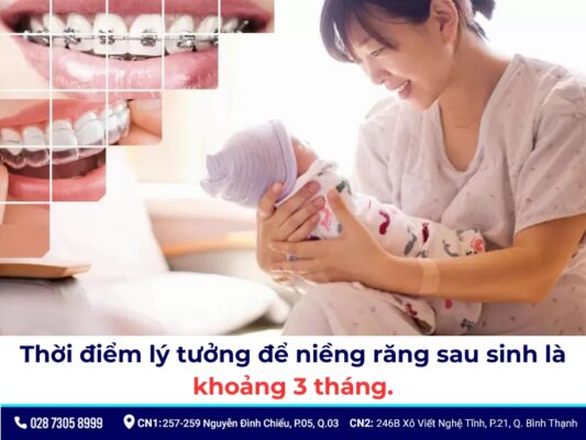 đang cho con bú có niềng răng được không - ảnh 2 đang cho con bú có niềng răng được không - ảnh 2