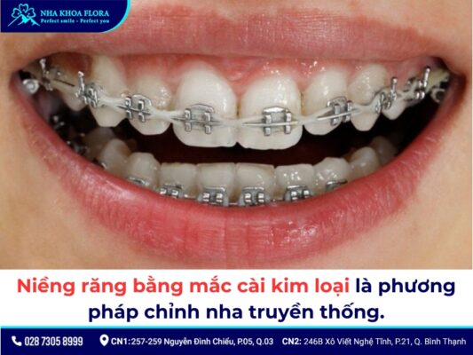 đang cho con bú có niềng răng được không - ảnh 3 đang cho con bú có niềng răng được không - ảnh 3