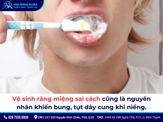đứt dây cung niềng răng - ảnh 3