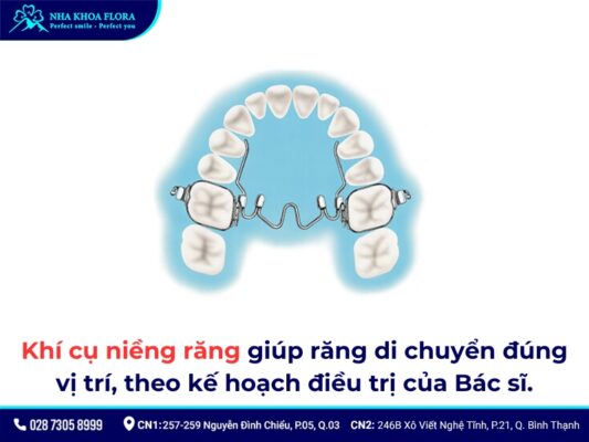 khí cụ niềng răng - ảnh 1