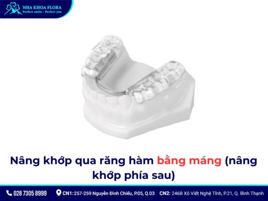 nâng khớp cắn niềng răng - ảnh 5