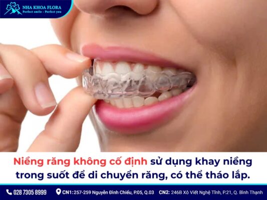 niềng răng có tháo ra được không - ảnh 2 niềng răng có tháo ra được không - ảnh 2