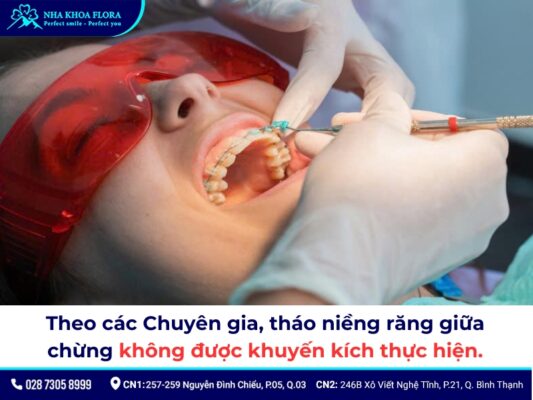 niềng răng có tháo ra được không - ảnh 3 niềng răng có tháo ra được không - ảnh 3