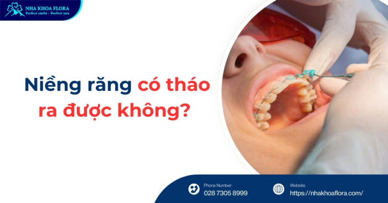 niềng răng có tháo ra được không