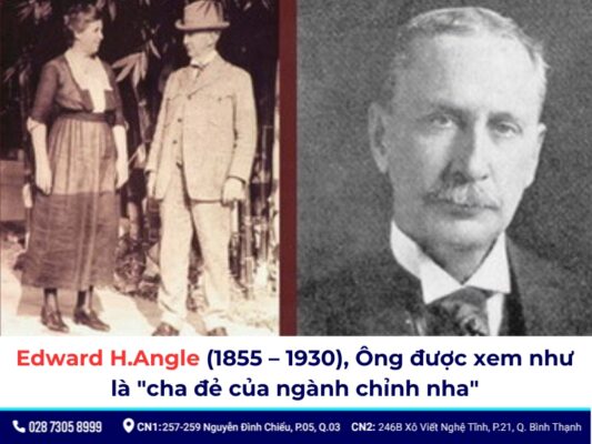 niềng răng thời xưa - ảnh 3