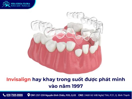 niềng răng thời xưa - ảnh 5