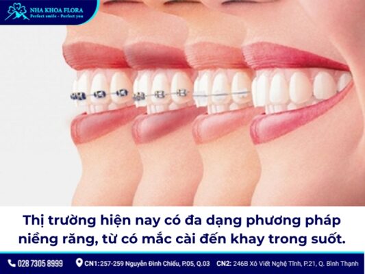 niềng răng thời xưa - ảnh 6